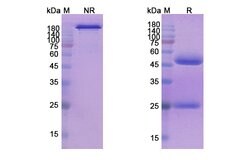 Invitrogen Seribantumab Recombinant Human Monoclonal Antibody 100 &mu;g;