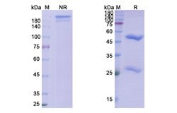 Invitrogen Pritoxaximab Chimeric Recombinant Human Monoclonal Antibody 100 &mu;g | Buy Online | Invitrogen&trade; | Fisher Scientific