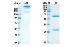 Invitrogen Eldelumab Recombinant Human Monoclonal Antibody 100 &mu;g; Unconjugated:Antibodies,