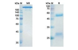 Invitrogen Dinutuximab Chimeric Recombinant Human Monoclonal Antibody 100