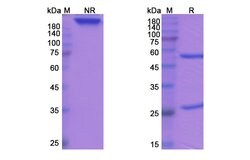 Invitrogen Tosatoxumab Recombinant Human Monoclonal Antibody 100 &mu;g;