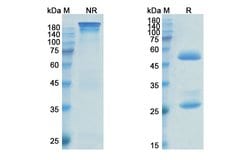 Invitrogen Anetumab Recombinant Human Monoclonal Antibody 100 &mu;g; Unconjugated:Antibodies,