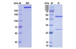 Invitrogen Anifrolumab Recombinant Human Monoclonal Antibody 100 &mu;g;