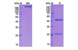 Invitrogen Lifastuzumab Humanized Recombinant Human Monoclonal Antibody 100 &mu;g | Buy Online | Invitrogen&trade; | Fisher Scientific