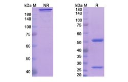 Invitrogen Fletikumab Recombinant Human Monoclonal Antibody 100 &mu;g;