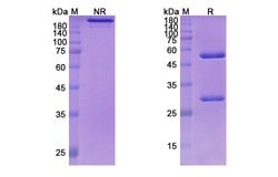 Invitrogen Coltuximab Chimeric Recombinant Human Monoclonal Antibody 100 &mu;g | Buy Online | Invitrogen&trade; | Fisher Scientific