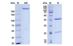 Invitrogen Diridavumab Recombinant Human Monoclonal Antibody 100 &mu;g;