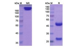 Invitrogen Begelomab Recombinant Mouse Monoclonal Antibody 100 &mu;g | Buy Online | Invitrogen&trade; | Fisher Scientific