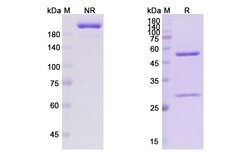 Invitrogen Obexelimab Chimeric Recombinant Human Monoclonal Antibody 100 &mu;g | Buy Online | Invitrogen&trade; | Fisher Scientific