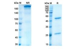 Invitrogen Lacutamab Chimeric Recombinant Human Monoclonal Antibody 100 &mu;g | Buy Online | Invitrogen&trade; | Fisher Scientific