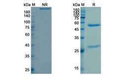 Invitrogen Durvalumab Humanized Recombinant Human Monoclonal Antibody 100