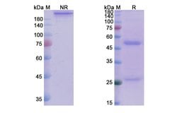 Invitrogen Andecaliximab Chimeric Recombinant Human Monoclonal Antibody