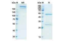 Dectrekumab Recombinant Human Monoclonal Antibody 100 &mu;g | Buy Online | Thermo Scientific | Fisher Scientific