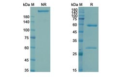 Invitrogen Navivumab Recombinant Human Monoclonal Antibody 100 &mu;g; Unconjugated:Antibodies,