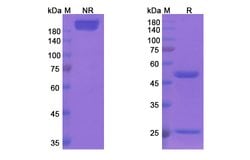 Invitrogen Clivatuzumab Humanized Recombinant Human Monoclonal Antibody 100 &mu;g | Buy Online | Invitrogen&trade; | Fisher Scientific
