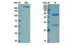 Invitrogen Ifabotuzumab Humanized Recombinant Human Monoclonal Antibody 100 &mu;g | Buy Online | Invitrogen&trade; | Fisher Scientific