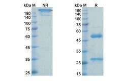 Invitrogen Rinucumab Recombinant Human Monoclonal Antibody 100 &mu;g | Buy Online | Invitrogen&trade; | Fisher Scientific