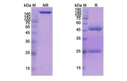 Invitrogen Refanezumab Humanized Recombinant Human Monoclonal Antibody