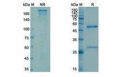 Invitrogen™ Carotuximab Chimeric Recombinant Human Monoclonal Antibody