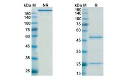 Invitrogen Timolumab Recombinant Human Monoclonal Antibody 100 &mu;g | Buy Online | Invitrogen&trade; | Fisher Scientific
