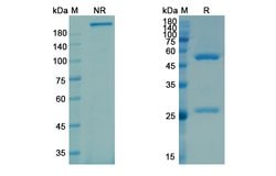 Invitrogen Galcanezumab Humanized Recombinant Human Monoclonal Antibody