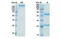 Invitrogen Birtamimab Chimeric Recombinant Human Monoclonal Antibody 100