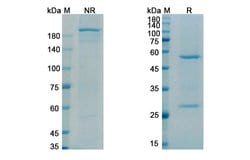 Invitrogen Apamistamab Recombinant Mouse Monoclonal Antibody 100 &mu;g | Buy Online | Invitrogen&trade; | Fisher Scientific