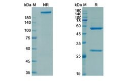 Invitrogen Rozanolixizumab Chimeric Recombinant Human Monoclonal Antibody 100 &mu;g | Buy Online | Invitrogen&trade; | Fisher Scientific
