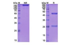 Invitrogen Depatuxizumab Chimeric Recombinant Human Monoclonal Antibody