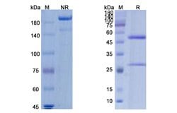 Invitrogen Burosumab Recombinant Human Monoclonal Antibody 100 &mu;g; Unconjugated:Antibodies,