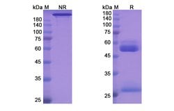 Invitrogen Aprutumab Recombinant Human Monoclonal Antibody 100 &mu;g | Buy Online | Invitrogen&trade; | Fisher Scientific