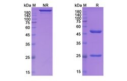 Invitrogen Vunakizumab Humanized Recombinant Human Monoclonal Antibody