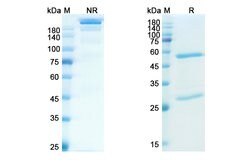 Invitrogen Brazikumab Recombinant Human Monoclonal Antibody 100 &mu;g;