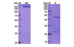 Invitrogen Crizanlizumab Humanized Recombinant Human Monoclonal Antibody 100 &mu;g | Buy Online | Invitrogen&trade; | Fisher Scientific
