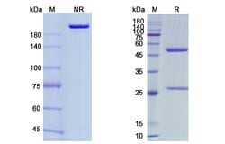 Invitrogen Maftivimab Recombinant Human Monoclonal Antibody 100 &mu;g | Buy Online | Invitrogen&trade; | Fisher Scientific