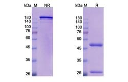Invitrogen Oleclumab Recombinant Human Monoclonal Antibody 100 &mu;g | Buy Online | Invitrogen&trade; | Fisher Scientific