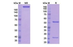 Invitrogen Sirtratumab Recombinant Human Monoclonal Antibody 100 &mu;g | Buy Online | Invitrogen&trade; | Fisher Scientific
