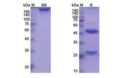 Invitrogen Ianalumab Recombinant Human Monoclonal Antibody 100 &mu;g; Unconjugated:Anticuerpos