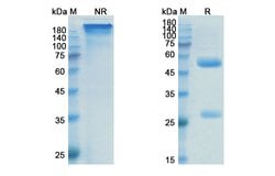 Invitrogen Prasinezumab Humanized Recombinant Human Monoclonal Antibody