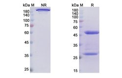 Invitrogen Narsoplimab Recombinant Human Monoclonal Antibody 100 &mu;g | Buy Online | Invitrogen&trade; | Fisher Scientific