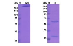 Invitrogen Etigilimab Humanized Recombinant Human Monoclonal Antibody 100