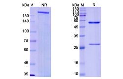Invitrogen Imaprelimab Humanized Recombinant Human Monoclonal Antibody 100 &mu;g | Buy Online | Invitrogen&trade; | Fisher Scientific