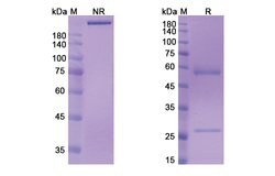 Invitrogen Murlentamab Humanized Recombinant Human Monoclonal Antibody