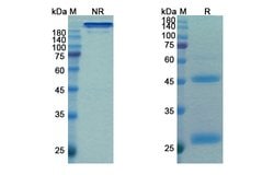 Invitrogen Budigalimab Chimeric Recombinant Human Monoclonal Antibody 100 &mu;g | Buy Online | Invitrogen&trade; | Fisher Scientific