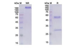 Invitrogen Marstacimab Recombinant Human Monoclonal Antibody 100 &mu;g;
