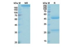 Invitrogen Omburtamab Recombinant Mouse Monoclonal Antibody 100 &mu;g;