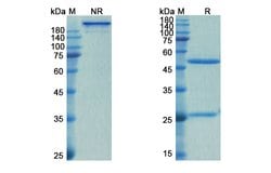 Invitrogen Spesolimab Humanized Recombinant Human Monoclonal Antibody 100