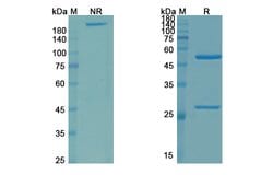 Invitrogen Zampilimab Chimeric Recombinant Human Monoclonal Antibody 100