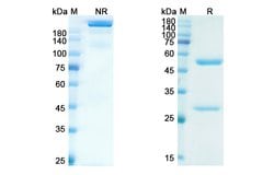 Invitrogen Levilimab Chimeric Recombinant Human Monoclonal Antibody 100 &mu;g | Buy Online | Invitrogen&trade; | Fisher Scientific