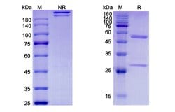 Invitrogen Etokimab Humanized Recombinant Human Monoclonal Antibody 100